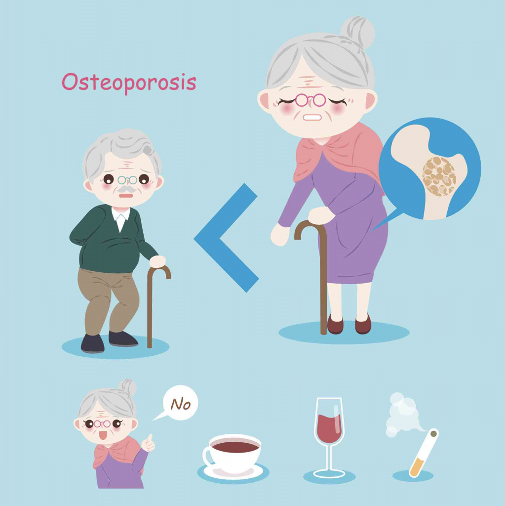 остеопороз и вредные привычки