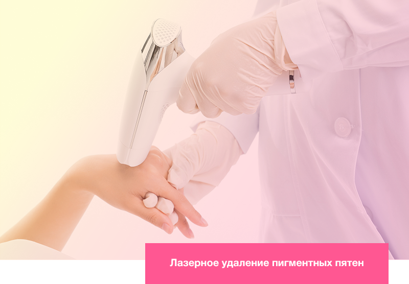 Лазерное удаление пигментных пятен Лазерное удаление пигментных пятен
