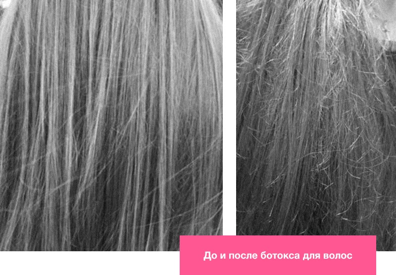 До и после ботокса для волос